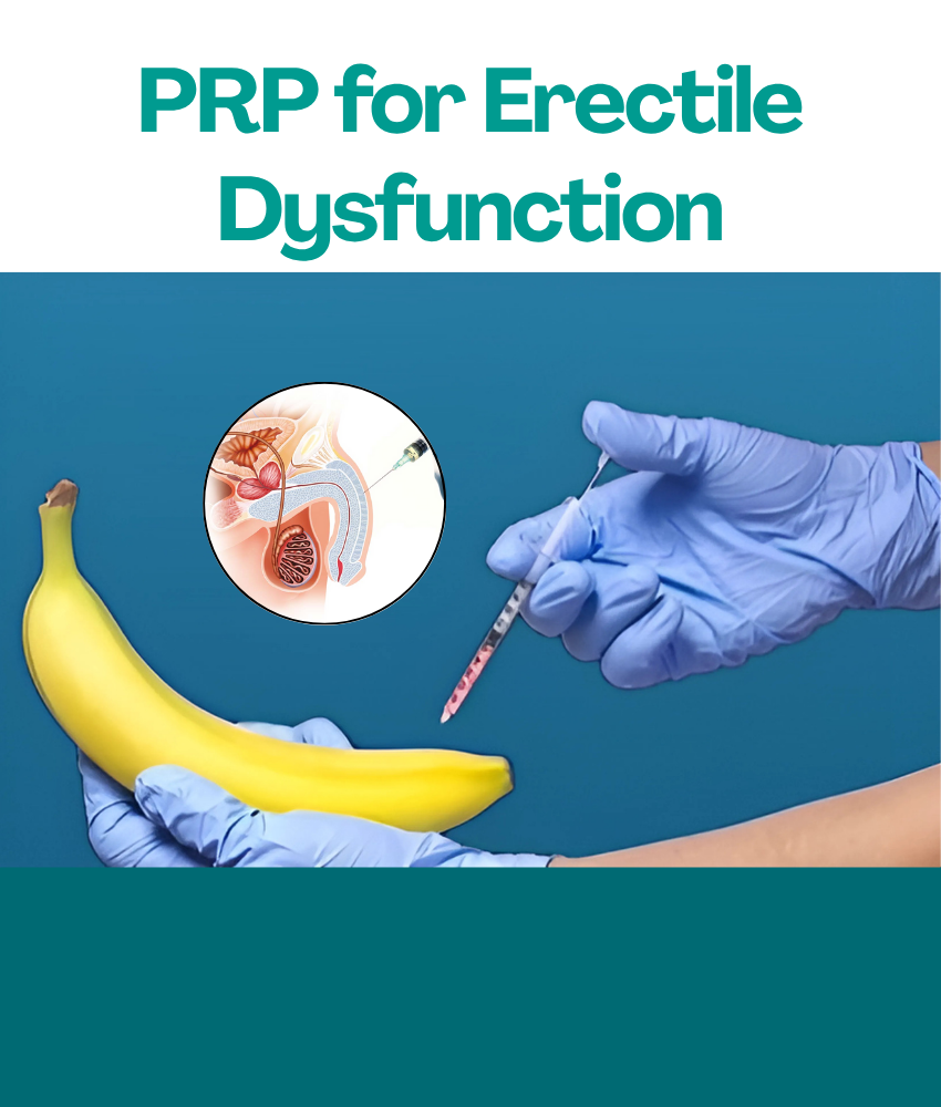 PRP For Erectile Dysfunction