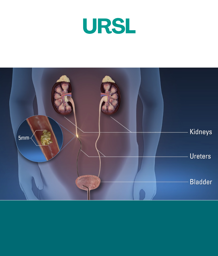 URSL